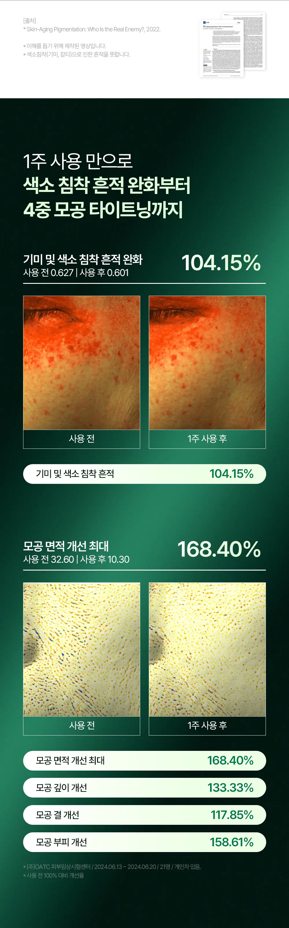 [티벳동생 공동개발] 오아조 피디알엔 쓰리디 부스팅 앰플 30ml 상세페이지 19